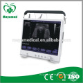 MY-A012 Portable ultrasound& ultrasound machine portable &ultrasound diagnostic equipment